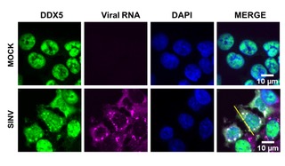 Analyse par microscopie confocale de la colocalisation de l'ARN viral