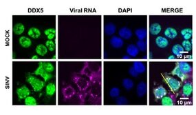 Analyse par microscopie confocale de la colocalisation de l'ARN viral